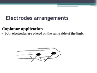 Electrodes arrangements
Coplanar application
• both electrodes are placed on the same side of the limb.
 