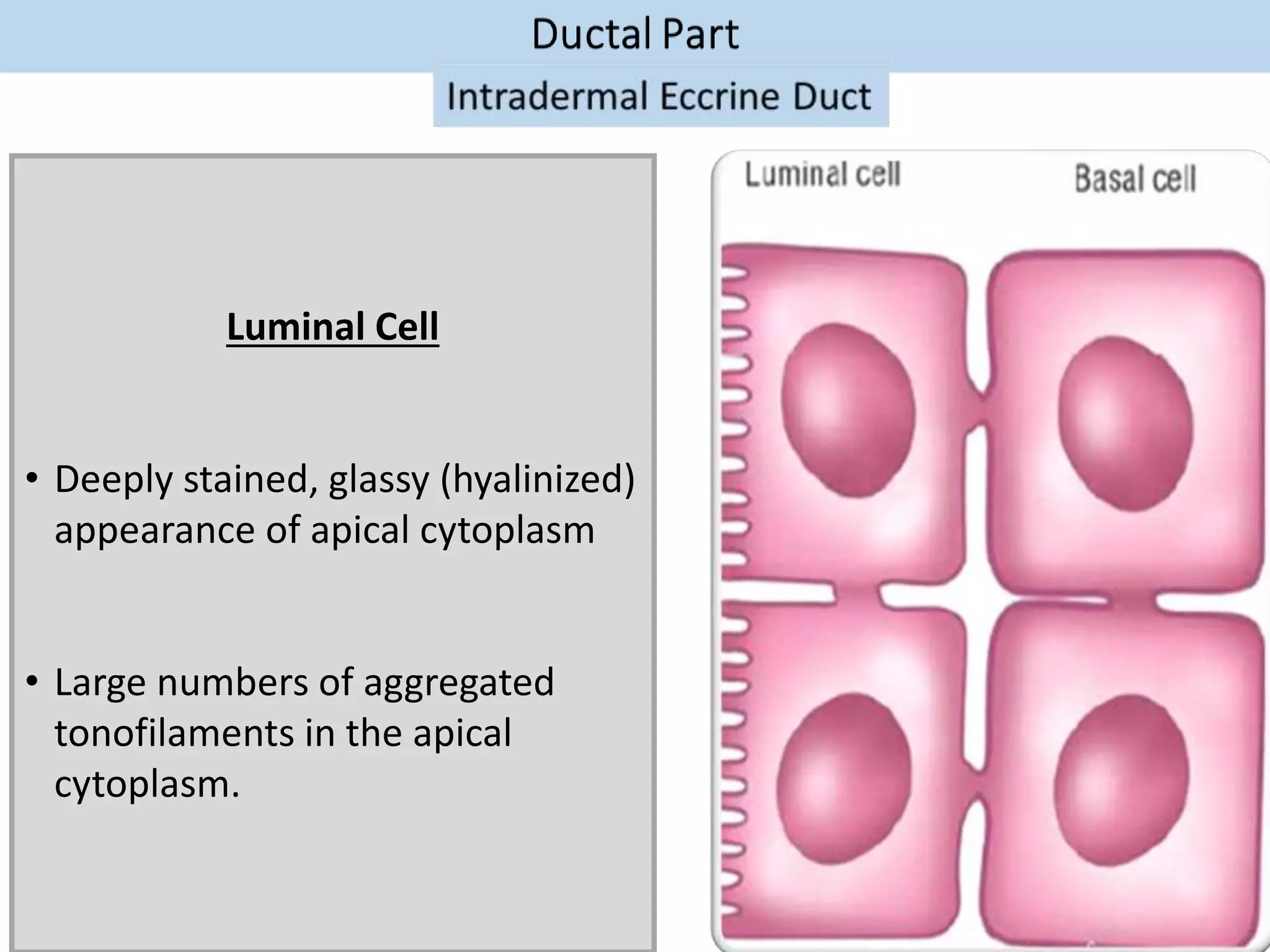 Luminal Cell
• Deeply stained, glassy (hyalinized)
appearance of apical cytoplasm
• Large numbers of aggregated
tonofilaments in the apical
cytoplasm.
 