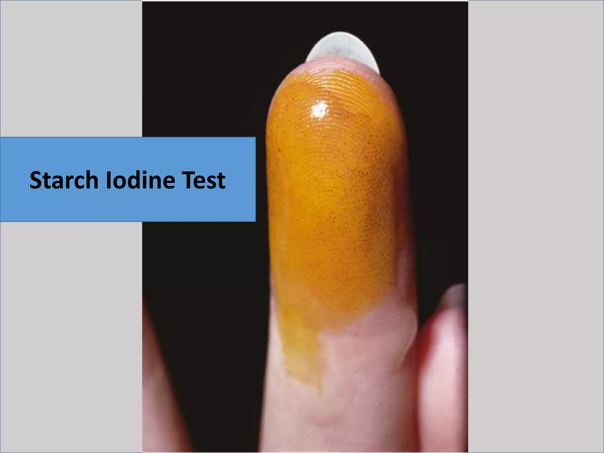 Starch Iodine Test
 