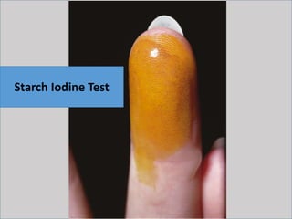 Starch Iodine Test
 