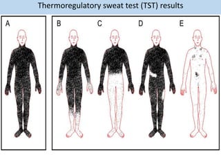 Thermoregulatory sweat test (TST) results
 