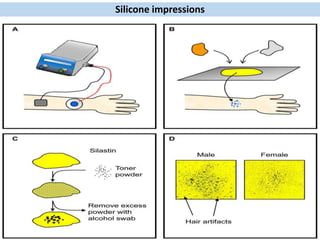 Silicone impressions
 