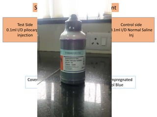 Sweat Testing in Our Department
Test Side
0.1ml I/D pilocarpine
injection
Control side
0.1ml I/D Normal Saline
Inj
Covered with Whatman No.1 filter paper strip impregnated
With 1% alcoholic solution of Bromophenol Blue
 