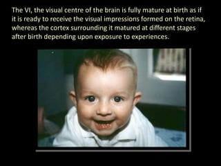 The VI, the visual centre of the brain is fully mature at birth as if it is ready to receive the visual impressions formed on the retina, whereas the cortex surrounding it matured at different stages after birth depending upon exposure to experiences.