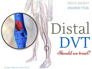 Distal DVT: Should we treat?