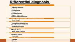 Comprehensive Overview of Sweet Syndrome: Pathogenesis, Clinical ...