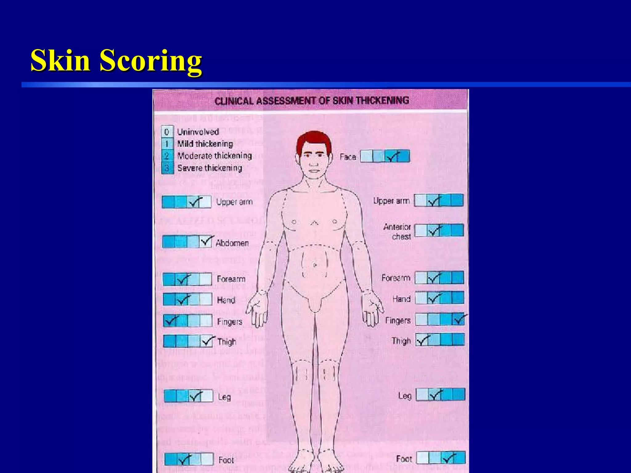 Overview of Scleroderma | PPT