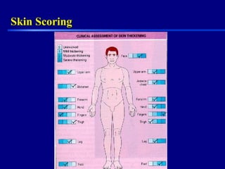 Skin ScoringSkin Scoring
 