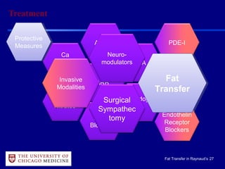 27Fat Transfer in Raynaud’s
Treatment
Ca
Channel
Blockers
ARB
Protective
Measures
Protective
Measures
PDE-I
Clopidogre
l
Endothelin
Receptor
Blockers
Alpha
Blockers
Topical
Nitrates
ACE-I
ASA
Prostanoid
s
Invasive
Modalities
Surgical
Sympathec
tomy
Neuro-
modulators
Fat
Transfer
Fat
Transfer
 