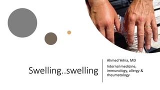 Swelling..swelling
Ahmed Yehia, MD
Internal medicine,
immunology, allergy &
rheumatology
 