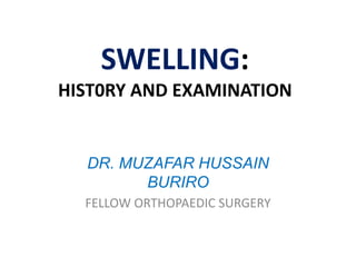 SWELLING:
HIST0RY AND EXAMINATION
DR. MUZAFAR HUSSAIN
BURIRO
FELLOW ORTHOPAEDIC SURGERY
 