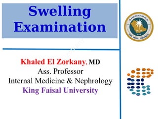 Swelling
Examination
Khaled El Zorkany, MD
Ass. Professor
Internal Medicine & Nephrology
King Faisal University
 