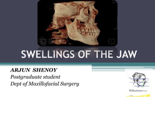 SWELLINGS OF THE JAW 
ARJUN SHENOY 
Postgraduate student 
Dept of Maxillofacial Surgery 
 