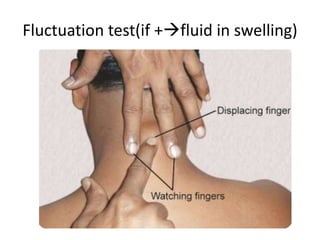 Fluctuation test(if +fluid in swelling)
 
