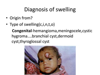 Diagnosis of swelling
• Origin from?
• Type of swelling(c,i,n,t,o)
Congenital-hemangioma,meningocele,cystic
hygroma....branchial cyst,dermoid
cyst,thyroglossal cyst
 