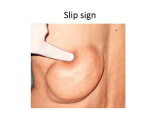 Slip sign
 