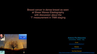 Antonio Pio Masciotra
Campobasso – Molise – Italy
Email
antoniomasciotra@yahoo.it
Website
www.masciotra.net
YouTube Channel
https://www.youtube.com/channel/UCgCj21nKGAhR997Ia3-QegQ
Breast cancer in dense breast as seen
at Shear Waves Elastography
with discussion about the
‘T’ measurement in TNM staging
 