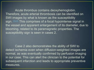 Acute thrombus contains deoxyhemoglobin.
Therefore, acute arterial thrombosis can be identified on
SWI images by what is known as the susceptibility
sign. [3],[4] This comprises of a focal hypointense signal in
the vessel and apparent enlargement of its diameter, due to
blooming, related to its paramagnetic properties. The
susceptibility sign is seen in cases 2.



       Case 2 also demonstrates the ability of SWI to
detect ischemia even when diffusion-weighted images are
normal, as was eventually confirmed by perfusion imaging
in our case. This can alert the clinician to the potential for
subsequent infarction and leads to appropriate preventive
measures.
 