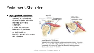 competitive swimming injuries- causes and prevention | PPTX