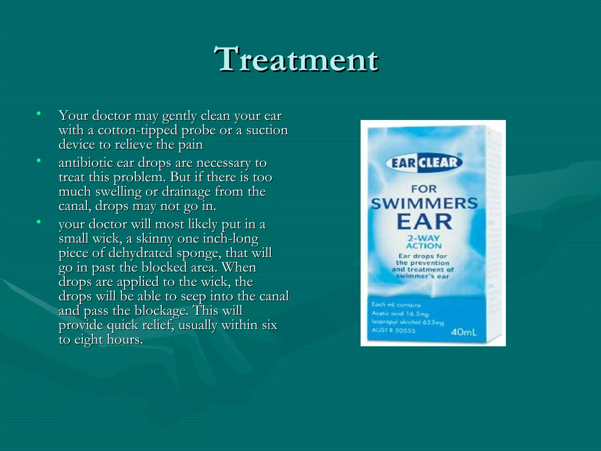 Swimmer’s ear roberto | PPT