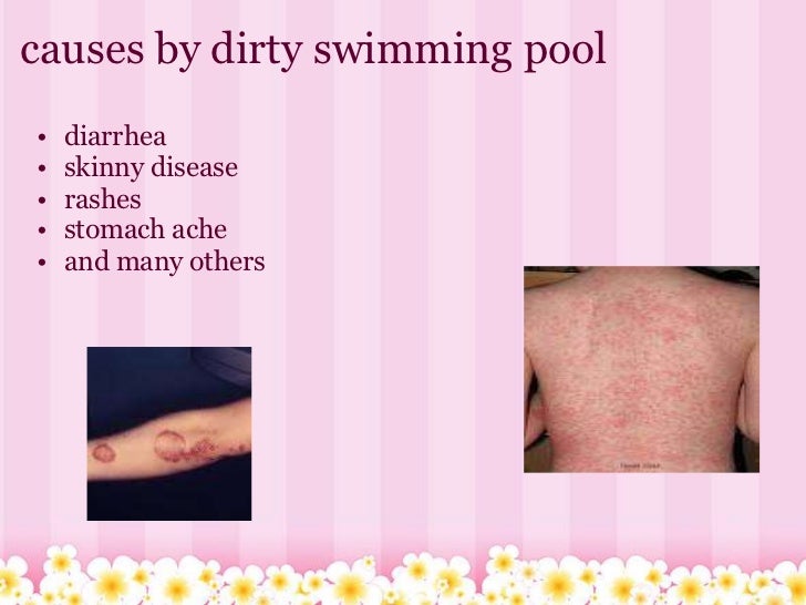 Swimming pool issues_aviral_and_ray_