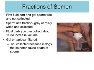 Fractions of Semen
• First fluid part and gel sperm free
and not collected
• Sperm rich fraction- gray or milky
white and collected
• Fluid part- you can collect about
1/3 to increase volume
• Gel or tapioca- filtered
– not collected because it clogs
the catheter cause death of
sperm
 