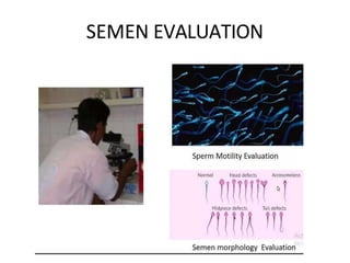 SEMEN EVALUATION
 