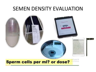 SEMEN DENSITY EVALUATION
 
