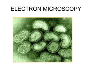 ELECTRON MICROSCOPY
 