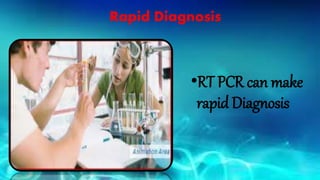 Rapid Diagnosis
•RT PCR can make
rapid Diagnosis
 