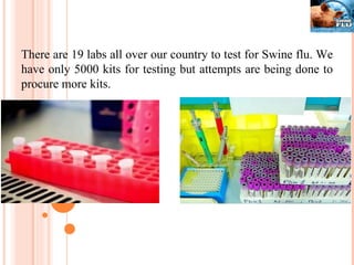 There are 19 labs all over our country to test for Swine flu. We have only 5000 kits for testing but attempts are being done to procure more kits. 