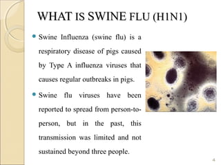WHATWHAT ISIS SWINESWINE FLU (H1N1)FLU (H1N1)
 Swine Influenza (swine flu) is a
respiratory disease of pigs caused
by Type A influenza viruses that
causes regular outbreaks in pigs.
 Swine flu viruses have been
reported to spread from person-to-
person, but in the past, this
transmission was limited and not
sustained beyond three people.
4
 