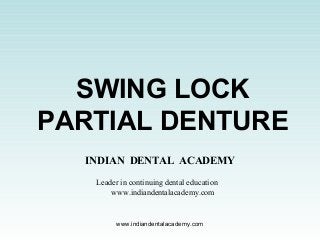 SWING LOCK
PARTIAL DENTURE
INDIAN DENTAL ACADEMY
Leader in continuing dental education
www.indiandentalacademy.com
www.indiandentalacademy.com
 