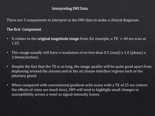 Swi seminar final | PPTX