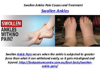 Swollen Ankles Pain Causes and Treatment
Swollen Ankles
Swollen Ankle Pain occurs when the ankle is subjected to greater
force than what it can withstand easily, so it gets misaligned and
injured. http://footposturecentre.com.au/foot-facts/swollen-
ankle-pain/
 