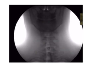 Human Digestive System- Mouth and Throat