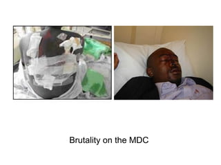 Brutality on the MDC
 