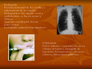 Radiografia Pocision horizontal de las costillas y aplanamiento de las cúpulas diafragmáticas los ángulos costo y cardiofrenicos se hacen rectos u obtusos  Aumento considerable del aire retroesternal Parénquima pulmonar hiperluminoso ETIOLOGIA Polvos irritantes contaminación aérea el humo del tabaco, bronquitis de repetición, bronquiectasias abscesos crónicos, tuberculosis pulmonar. 