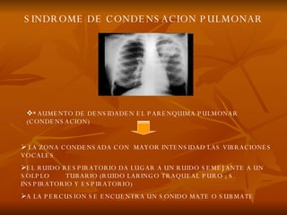 SINDROME DE CONDENSACION PULMONAR * AUMENTO DE DENSIDADEN EL PARENQUIMA PULMONAR (CONDENSACION) LA ZONA CONDENSADA CON  MAYOR INTENSIDAD LAS VIBRACIONES VOCALES EL RUIDO RESPIRATORIO DA LUGAR A UN RUIDO SEMEJANTE A UN SOLPLO  TUBARIO (RUIDO LARINGO TRAQUEAL PURO ; S. INSPIRATORIO Y ESPIRATORIO) A LA PERCUSION SE ENCUENTRA UN SONIDO MATE O SUBMATE 