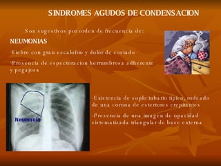 Son sugestivos por orden de frecuencia de: NEUMONIAS Fiebre con gran escalofrio y dolor de costado  Presencia de espectoracion herrumbrosa adherente y pegajosa SINDROMES AGUDOS DE CONDENSACION -Existencia de soplo tubario típico, rodeado de una corona de estertores crepitantes  -Presencia de una imagen de opacidad sistematizada triangular de base externa 