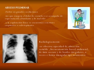 ABSESO PULMONAR -Fiebre en grandes oscilaciones -tos que exagera el dolor de costado y se acompaña de expectoración abundante y de mal olor -a la exploración física se encuentran estertores crepitantes o subcrepitantes Radiologicamente -se observa opacidad de ubicación variable , frecuentemente basal, unilateral, de tinte oscuro y de bordes irregulares, a veces e forma triangular tipo neumonico 