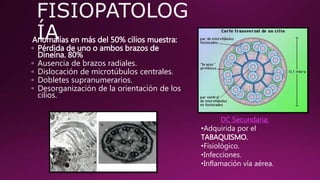 Anomalías en más del 50% cilios muestra:
▫ Pérdida de uno o ambos brazos de
Dineína. 80%
▫ Ausencia de brazos radiales.
▫ Dislocación de microtúbulos centrales.
▫ Dobletes supranumerarios.
▫ Desorganización de la orientación de los
cilios.
DC Secundaria:
•Adquirida por el
TABAQUISMO.
•Fisiológico.
•Infecciones.
•Inflamación vía aérea.
 