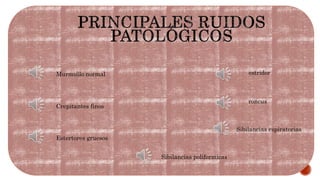 Murmullo normal
Crepitantes finos
Estertores gruesos
estridor
roncus
Sibilancias espiratorias
Sibilancias poliformicas