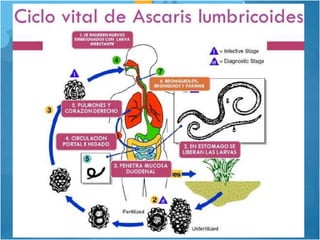 Sindrome de Loeffler | PPTX