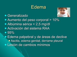 Edema Generalizado Aumento del peso corporal > 10% Albúmina sérica < 2,5 mg/dl Activación del sistema RAA 95% Edema palpebral y de áreas de declive Ascitis, edema genital, derrame pleural Lesión de cambios mínimos 