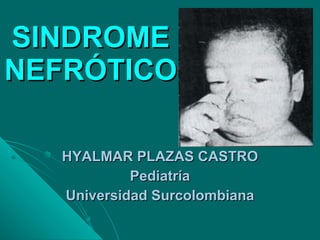 SINDROME NEFRÓTICO HYALMAR PLAZAS CASTRO Pediatría Universidad Surcolombiana 