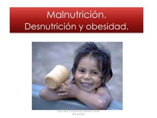 Malnutrición.Desnutrición y obesidad. Sara Ireri Castorena Herrera HGM IPN 6CM3 