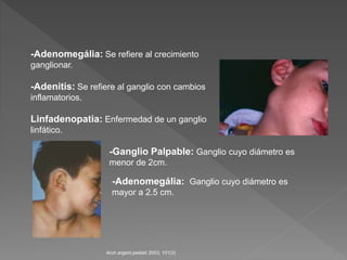 s-ndromes-adenomeg-licos-pediatria-pptx