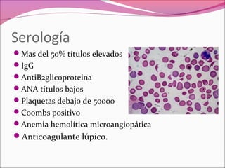 Serología
Mas del 50% títulos elevados
IgG
AntiB2glicoproteina
ANA títulos bajos
Plaquetas debajo de 50000
Coombs positivo
Anemia hemolítica microangiopática
Anticoagulante lúpico.
 