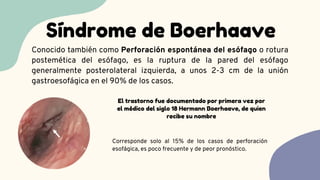 Síndrome de Boerhaave
El trastorno fue documentado por primera vez por
el médico del siglo 18 Hermann Boerhaave, de quien
recibe su nombre
Conocido también como Perforación espontánea del esófago o rotura
postemética del esófago, es la ruptura de la pared del esófago
generalmente posterolateral izquierda, a unos 2-3 cm de la unión
gastroesofágica en el 90% de los casos.
Corresponde solo al 15% de los casos de perforación
esofágica, es poco frecuente y de peor pronóstico.
 